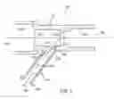 Fig. 04 - Catheter hubs and valves for minimizing embolic potential
