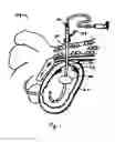 Fig. 02 - Catheter snugger system and method
