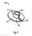 Fig. 04 - Catheter snugger system and method