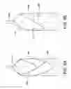 Fig. 07 - Controllable inflation profile balloon cover methods