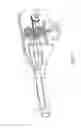 Fig. 08 - MEDICAL BALLOON