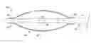 Fig. 01 - Lithotripsy Angioplasty Devices and Methods