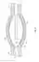 Fig. 06 - Lithotripsy Angioplasty Devices and Methods