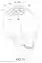 Fig. 16 - Cerebral spinal fluid shunt plug