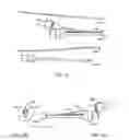 Fig. 07 - System and method for treatment of target tissues within the ears