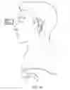 Fig. 11 - System and method for treatment of target tissues within the ears