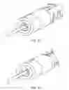 Fig. 16 - System and method for treatment of target tissues within the ears
