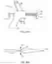 Fig. 22 - System and method for treatment of target tissues within the ears