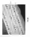 Fig. 12 - Apparatuses and methods for negative pressure wound therapy