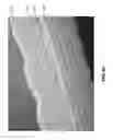Fig. 13 - Apparatuses and methods for negative pressure wound therapy