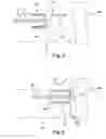 Fig. 04 - PERCUTANEOUS MULTI-PRONGED LEAD