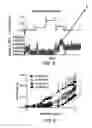 Fig. 09 - Lead placement for nerve stimulation
