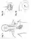 Fig. 02 - Implantable neurostimulator-implemented method for enhancing heart failure patient awakening through vagus nerve stimulation