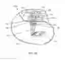 Fig. 22 - Hermetically sealed filtered feedthrough assembly having a capacitor with an oxide resistant electrical connection to an active implantable medical device housing