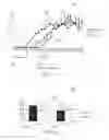 Fig. 09 - Light therapy treatment