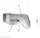Fig. 02 - SYSTEMS, DEVICES, AND METHODS FOR ADMINISTERING LOW-LEVEL LIGHT THERAPY