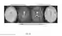 Fig. 06 - Systems and methods for adaptive replanning based on multi-modality imaging