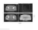 Fig. 09 - Systems and methods for adaptive replanning based on multi-modality imaging