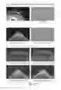 Fig. 16 - Systems and methods for adaptive replanning based on multi-modality imaging