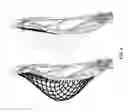 Fig. 09 - Pocket-Channeling Lacrosse Head