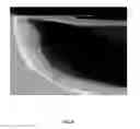 Fig. 06 - Methods for creating fluidic cavities by transmembrane etching through porous membranes and structures made thereby and uses of such structures