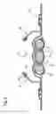 Fig. 07 - Method of making surface-coated water-absorbing polymer particles in a microfluidic device