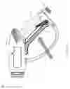 Fig. 04 - Pressure washer safely lock