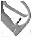 Fig. 11 - Pressure washer safely lock