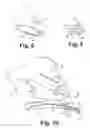 Fig. 07 - Guide catheter slitter