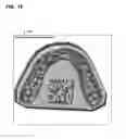 Fig. 20 - FABRICATION OF AN ORTHODONTIC ALIGNER FROM A NEGATIVE MOLD DESIGNED BY A COMPUTATIONAL DEVICE