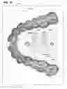 Fig. 22 - FABRICATION OF AN ORTHODONTIC ALIGNER FROM A NEGATIVE MOLD DESIGNED BY A COMPUTATIONAL DEVICE