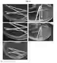 Fig. 07 - Manufacturing device of nerve conduits