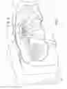 Fig. 02 - Rotatably supported airbag