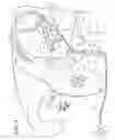 Fig. 02 - BRAKE LINE BLEEDING DEVICE