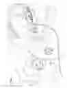 Fig. 04 - BRAKE LINE BLEEDING DEVICE