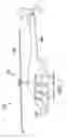 Fig. 02 - Deployable apparatus to prevent helicopter rollover