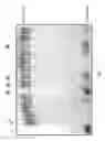 Fig. 02 - Materials and method for inhibiting replication protein A and uses thereof