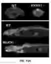Fig. 28 - Pharmaceutical composition for preventing and treating metabolic disease comprising MKRN1 expression or activity inhibitor as an active ingredient