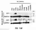Fig. 44 - Pharmaceutical composition for preventing and treating metabolic disease comprising MKRN1 expression or activity inhibitor as an active ingredient