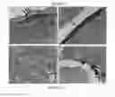 Fig. 22 - Listeria-Based Immunogenic Compositions And Methods Of Use Thereof in Cancer Prevention And Treatment