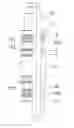Fig. 01 - Central shaft for bridge plug, bridge plug and setting method for the same