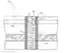 Fig. 01 - Scheduling treatment fluid placement and fluid diversion in a subterranean formation