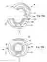 Fig. 07 - High-pressure fuel pump