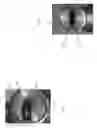Fig. 03 - Concealed three port flushometer system
