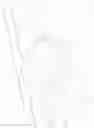 Fig. 08 - Suppressor cover assembly and method