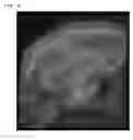 Fig. 07 - Composition for clearing of biotissue and clarity method for biotissue using thereof