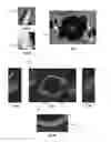 Fig. 03 - Intraocular lens inspection