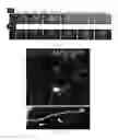 Fig. 07 - ASTROCYTE DIFFERENTIATION PROTOCOL