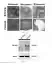 Fig. 19 - ASTROCYTE DIFFERENTIATION PROTOCOL