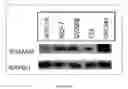 Fig. 02 - Materials and methods for detecting cancer based on urinary levels of RHAMM